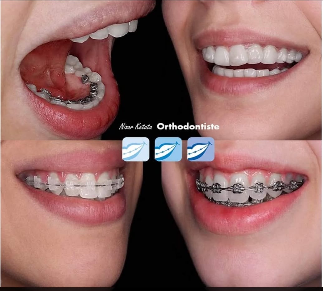Orthodontiste Sfax Dr Ketata Nizar
